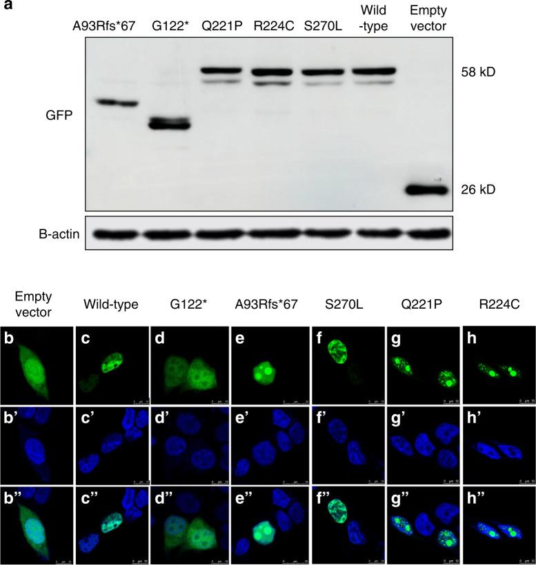 https://cdn.ncbi.nlm.nih.gov/pmc/blobs/2783/7794556/39ee4b993b7c/41368_2020_106_Fig4_HTML.jpg