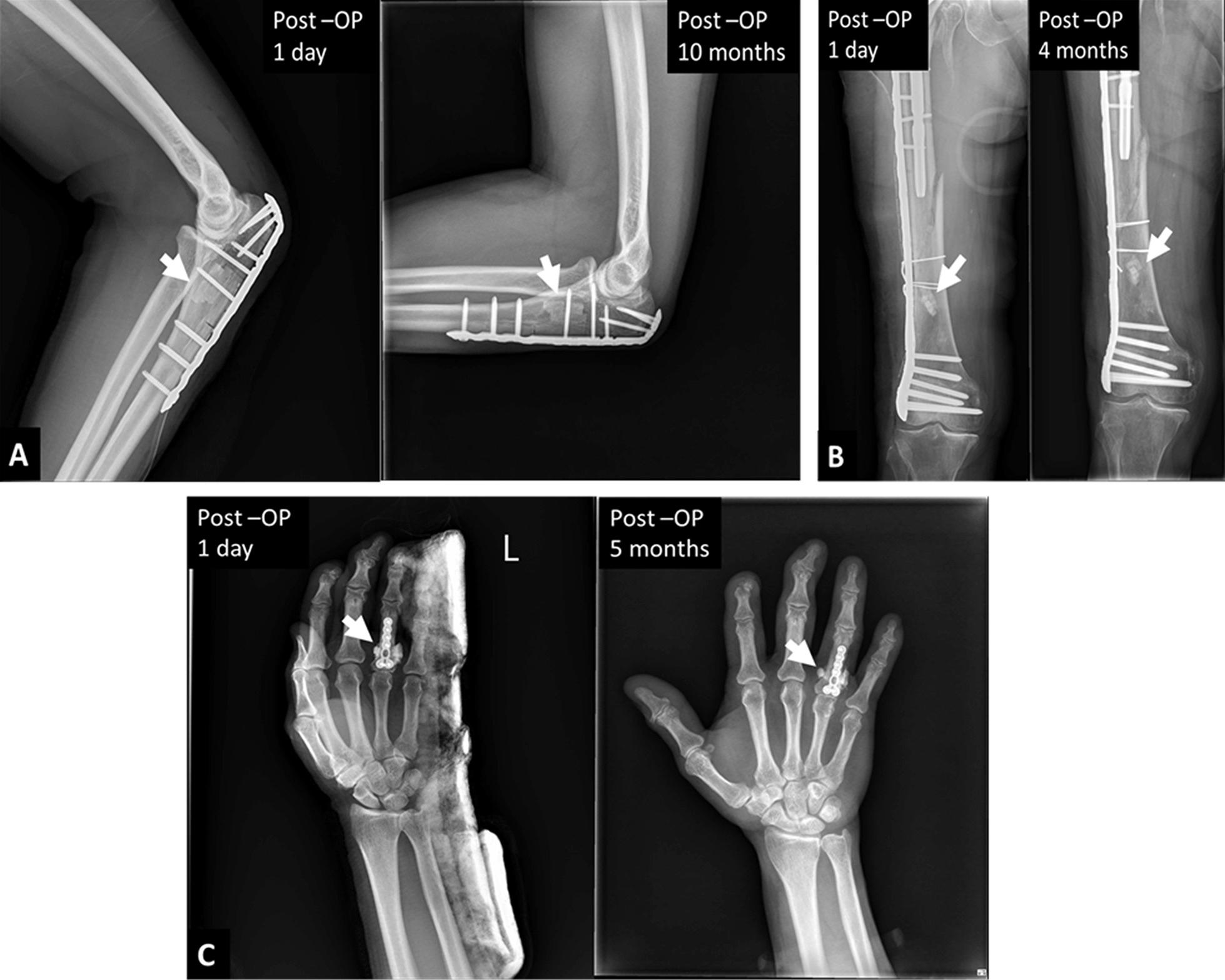 https://cdn.ncbi.nlm.nih.gov/pmc/blobs/2788/9675207/b9305d2eaf9c/13018_2022_3385_Fig5_HTML.jpg