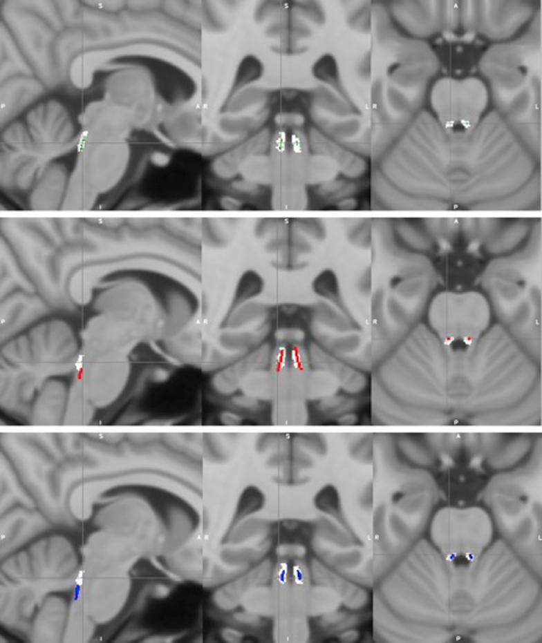 https://cdn.ncbi.nlm.nih.gov/pmc/blobs/278b/6338679/429e5efb6bc5/gr4.jpg