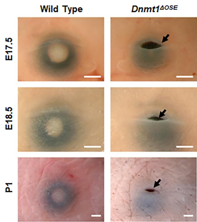 https://cdn.ncbi.nlm.nih.gov/pmc/blobs/2797/12085216/527aeb3a1fe9/mv-v31-85-f4.jpg