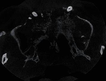https://cdn.ncbi.nlm.nih.gov/pmc/blobs/279a/8016570/155f0eeb2e89/CRID2021-8853649.005.jpg