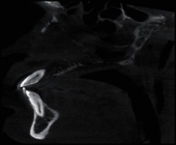 https://cdn.ncbi.nlm.nih.gov/pmc/blobs/279a/8016570/d734e96f2416/CRID2021-8853649.007.jpg