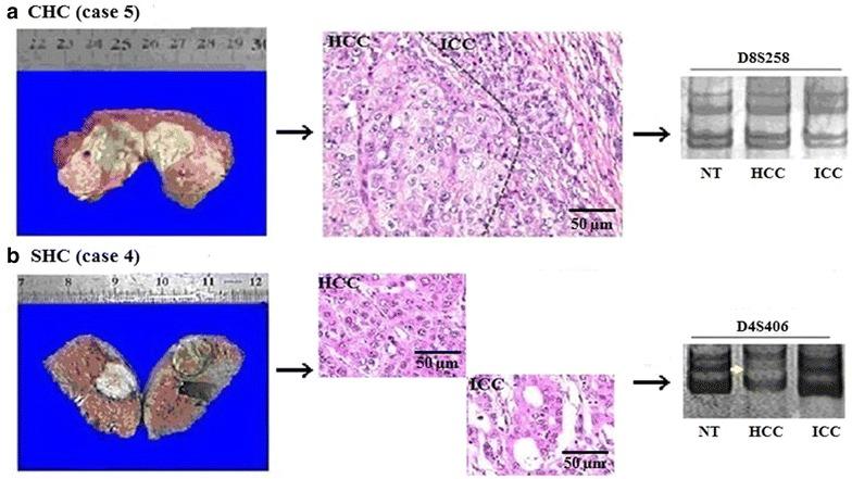 https://cdn.ncbi.nlm.nih.gov/pmc/blobs/27a4/4995671/e73f407b2bee/40880_2016_146_Fig1_HTML.jpg