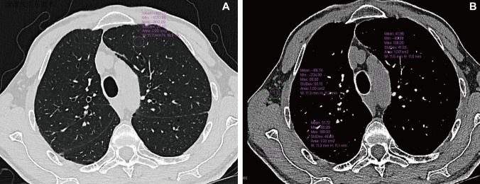 https://cdn.ncbi.nlm.nih.gov/pmc/blobs/27a8/12367857/213b4d28efe5/11547_2025_2057_Fig2_HTML.jpg