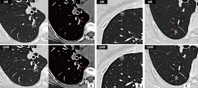 https://cdn.ncbi.nlm.nih.gov/pmc/blobs/27a8/12367857/c3e924b8e310/11547_2025_2057_Fig5_HTML.jpg