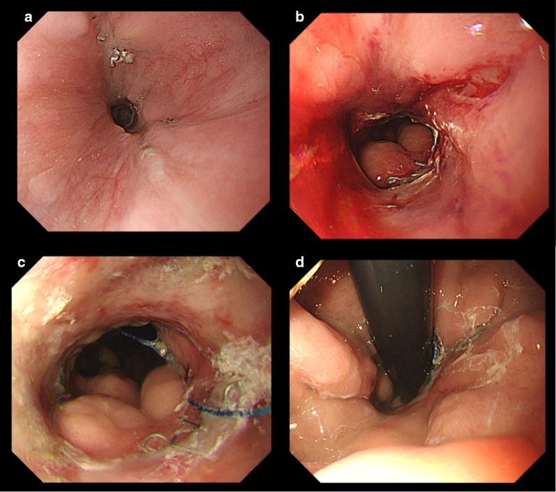 https://cdn.ncbi.nlm.nih.gov/pmc/blobs/27a9/7683626/8e3731fd20b0/40792_2020_1056_Fig4_HTML.jpg