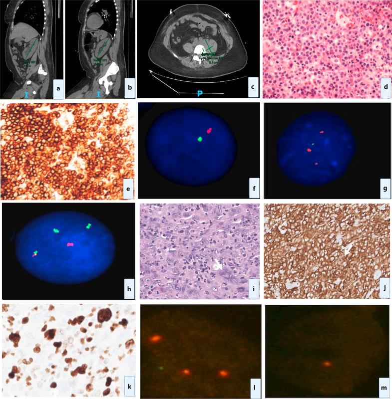 https://cdn.ncbi.nlm.nih.gov/pmc/blobs/27ad/12270463/0d98a9f891e9/pat-2025-0000-0000-546669_F01.jpg