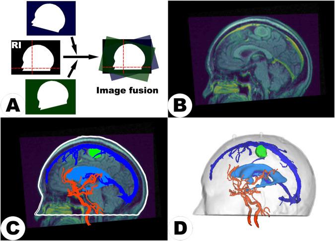 https://cdn.ncbi.nlm.nih.gov/pmc/blobs/27b1/11127921/e6deecab0545/41597_2024_3385_Fig2_HTML.jpg