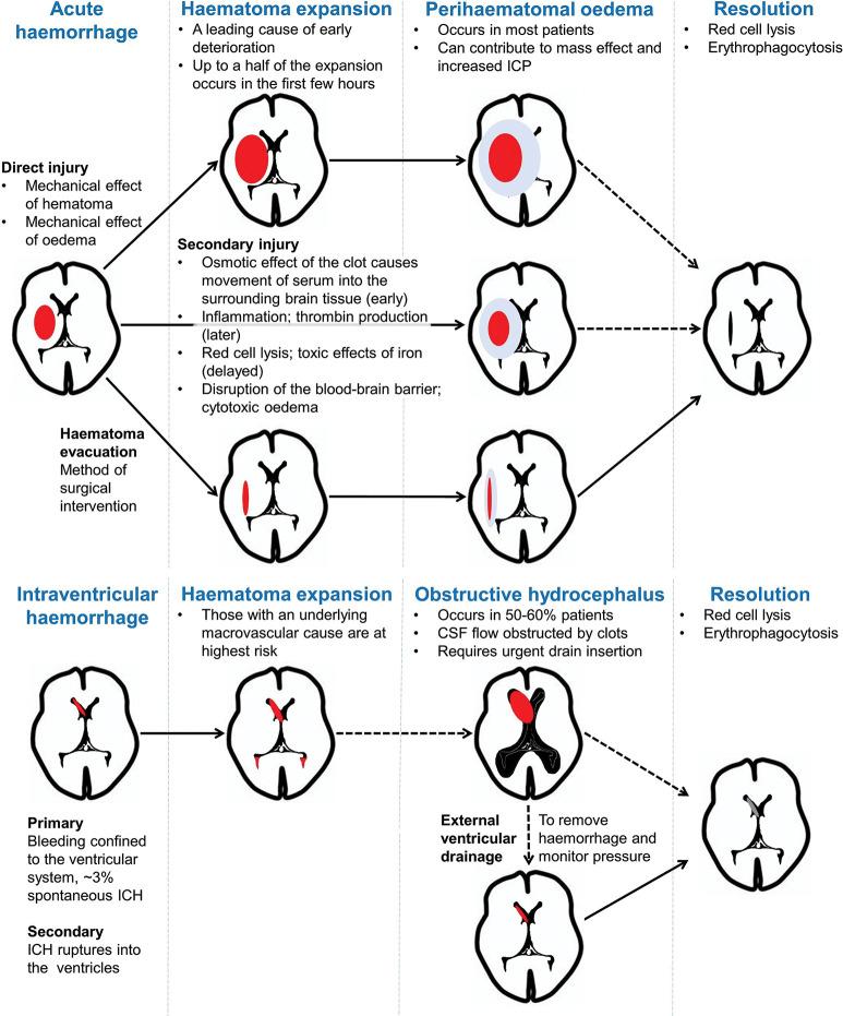 https://cdn.ncbi.nlm.nih.gov/pmc/blobs/27b2/7982923/5eace8443bf1/practneurol-2020-002763f04.jpg