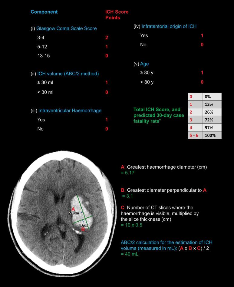https://cdn.ncbi.nlm.nih.gov/pmc/blobs/27b2/7982923/ac702d705c45/practneurol-2020-002763f01.jpg