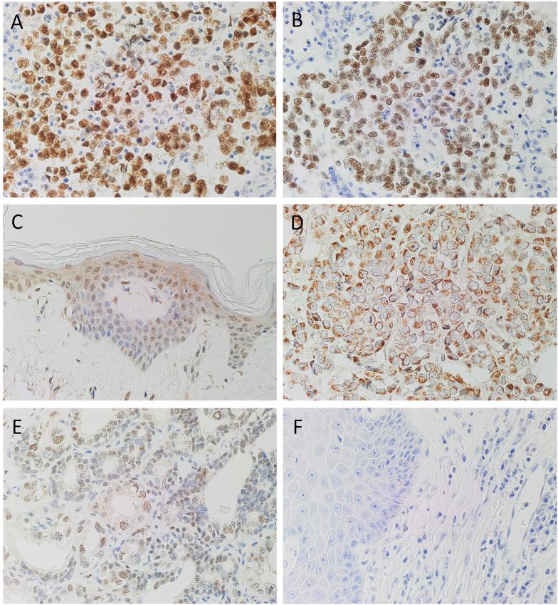 https://cdn.ncbi.nlm.nih.gov/pmc/blobs/27b4/6709152/08c84113fb90/gr3.jpg