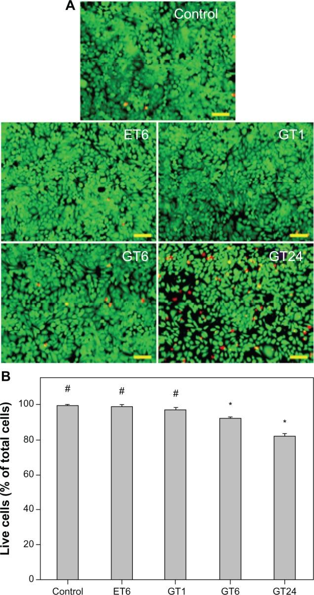 https://cdn.ncbi.nlm.nih.gov/pmc/blobs/27c0/3817029/102f0c876ea6/ijn-8-4157Fig4.jpg