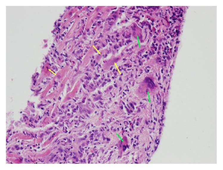 https://cdn.ncbi.nlm.nih.gov/pmc/blobs/27c6/4921131/c2a6e10596c5/BMRI2016-4087632.001.jpg