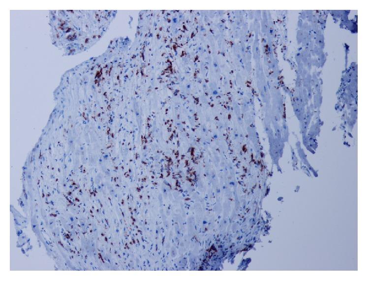 https://cdn.ncbi.nlm.nih.gov/pmc/blobs/27c6/4921131/df4dee685907/BMRI2016-4087632.003.jpg