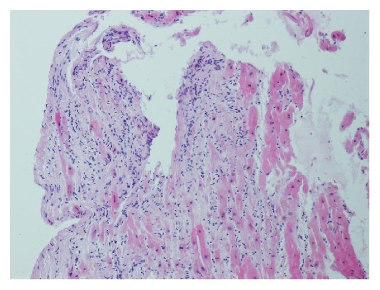 https://cdn.ncbi.nlm.nih.gov/pmc/blobs/27c6/4921131/e7426f0e33a5/BMRI2016-4087632.002.jpg