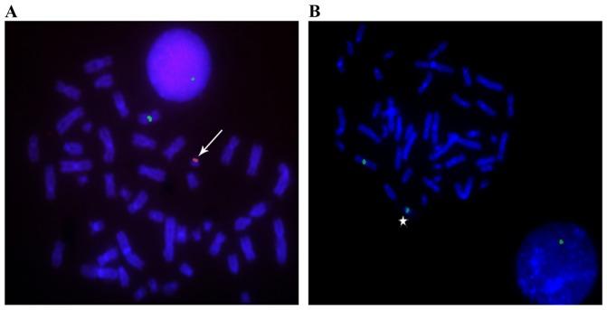 https://cdn.ncbi.nlm.nih.gov/pmc/blobs/27cc/5452876/fe78ac93680e/ol-13-06-4385-g00.jpg