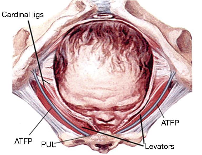 https://cdn.ncbi.nlm.nih.gov/pmc/blobs/27d0/11075961/5235a219753f/atm-12-02-23-f7.jpg