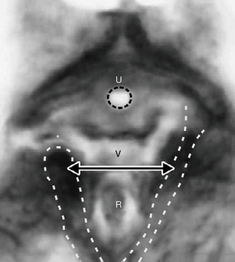 https://cdn.ncbi.nlm.nih.gov/pmc/blobs/27d0/11075961/8c362ec6dd4c/atm-12-02-23-f8.jpg