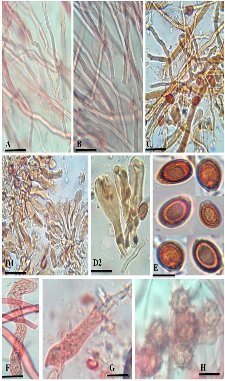 https://cdn.ncbi.nlm.nih.gov/pmc/blobs/27d5/11303310/4e6231aec2c3/fmicb-15-1411264-g0003.jpg