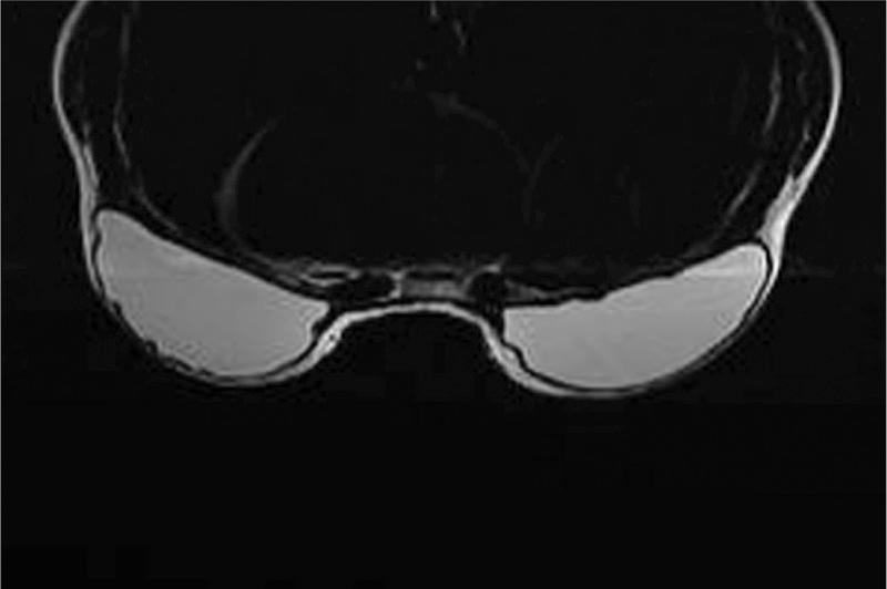 https://cdn.ncbi.nlm.nih.gov/pmc/blobs/27d6/4399443/9606c2d434ad/sju08406.jpg