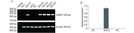https://cdn.ncbi.nlm.nih.gov/pmc/blobs/27df/6000437/09d0aa8b4503/zgfazz-13-4-317-3.jpg