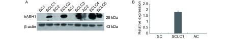 https://cdn.ncbi.nlm.nih.gov/pmc/blobs/27df/6000437/fa730da2a25e/zgfazz-13-4-317-2.jpg