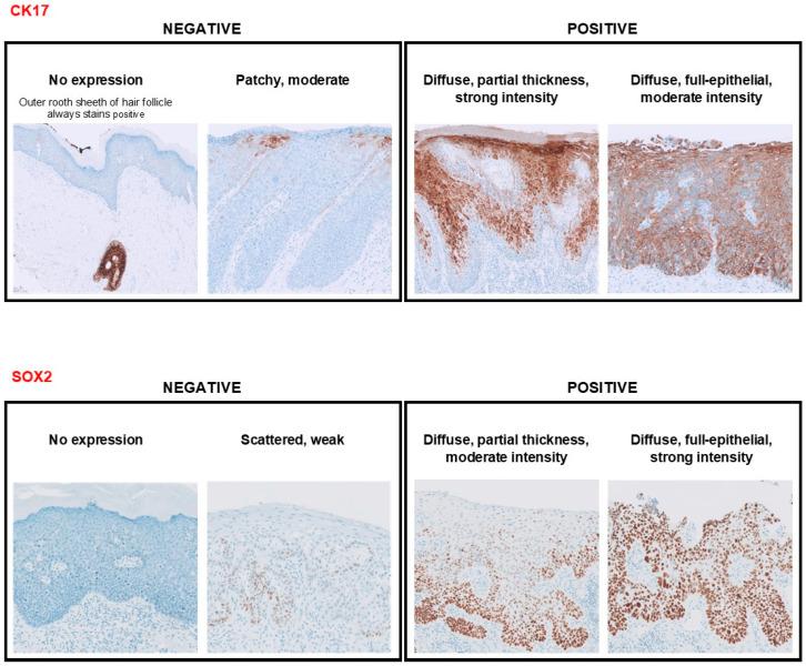 https://cdn.ncbi.nlm.nih.gov/pmc/blobs/27e0/11640302/774864545f40/cancers-16-03966-g001.jpg