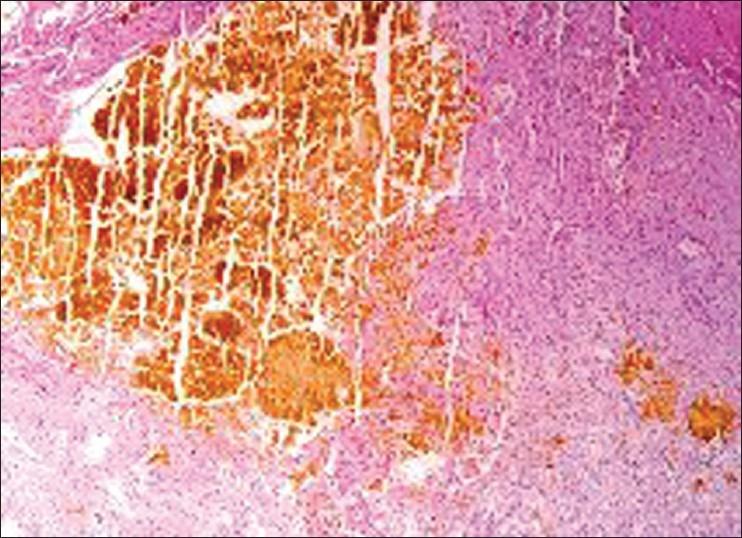 https://cdn.ncbi.nlm.nih.gov/pmc/blobs/27e1/3518991/b624cfcba2a2/JIAPS-17-147-g004.jpg