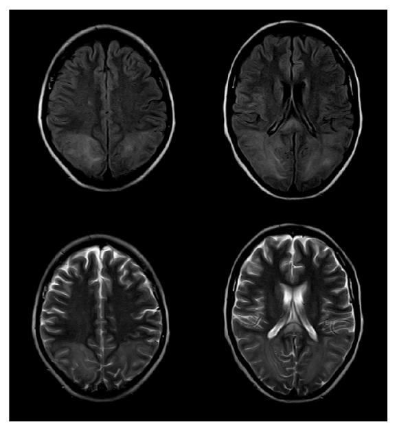 https://cdn.ncbi.nlm.nih.gov/pmc/blobs/27f0/5402235/1642c2d66e25/CRINM2017-1835796.001.jpg