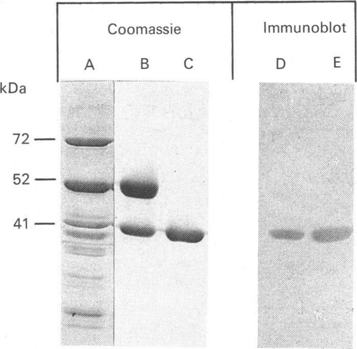 https://cdn.ncbi.nlm.nih.gov/pmc/blobs/27f1/1130553/636d4842aa23/biochemj00146-0081-a.jpg