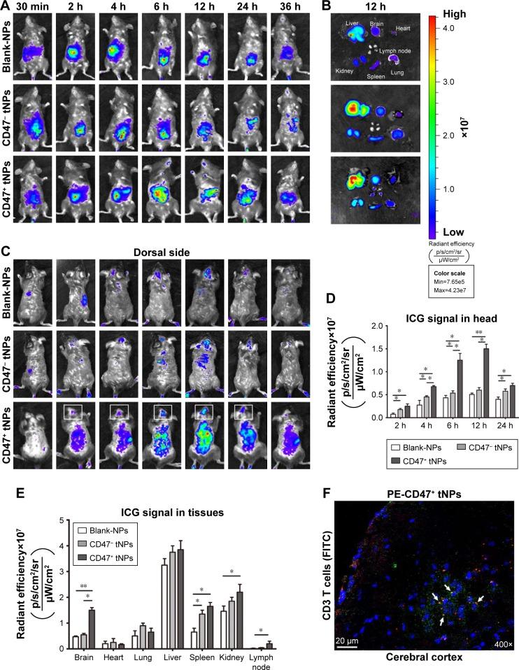 https://cdn.ncbi.nlm.nih.gov/pmc/blobs/27f1/6027825/9d9c6e76da63/ijn-13-3731Fig4.jpg
