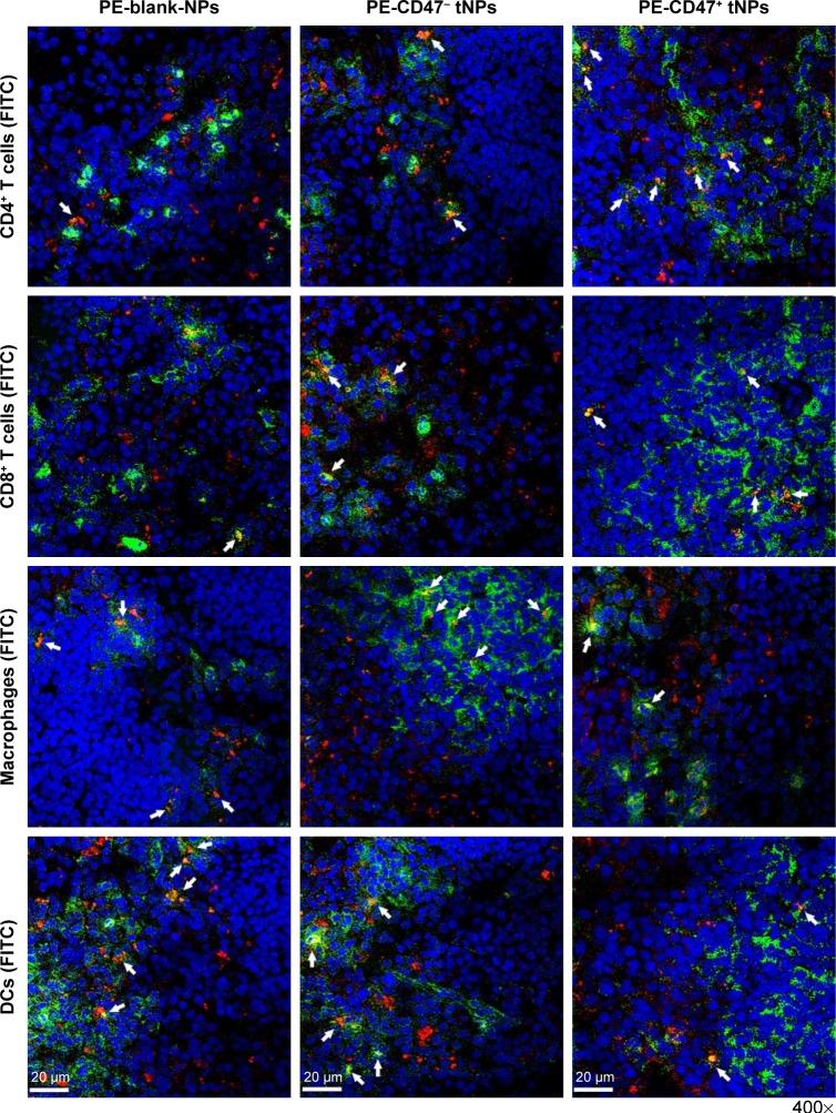 https://cdn.ncbi.nlm.nih.gov/pmc/blobs/27f1/6027825/d9ed11c1d2d9/ijn-13-3731Fig5.jpg