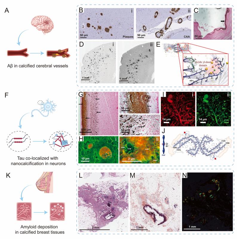https://cdn.ncbi.nlm.nih.gov/pmc/blobs/27f5/12149555/042302fd7422/gr3.jpg