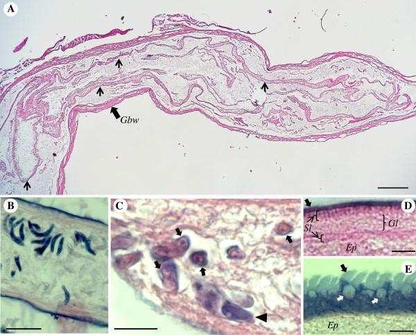https://cdn.ncbi.nlm.nih.gov/pmc/blobs/27f9/3626897/b5f0898474ae/1756-3305-6-51-2.jpg