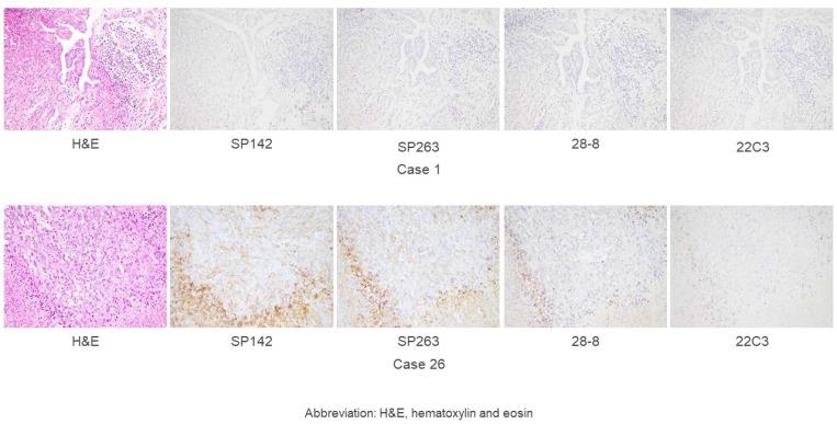 https://cdn.ncbi.nlm.nih.gov/pmc/blobs/27fa/5945532/b3ed65433992/oncotarget-09-20769-g002.jpg