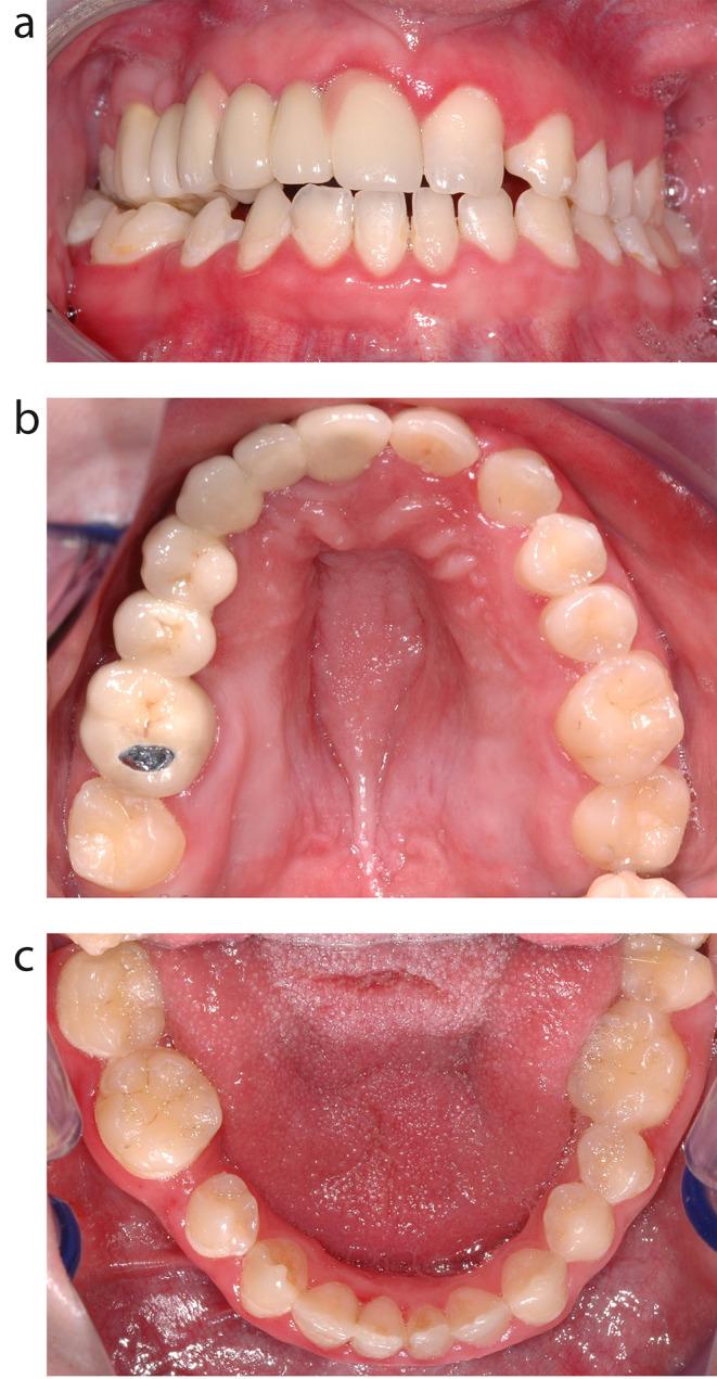 https://cdn.ncbi.nlm.nih.gov/pmc/blobs/27fb/11289360/a9e08751a8b6/784_2024_5846_Fig1_HTML.jpg