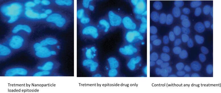 https://cdn.ncbi.nlm.nih.gov/pmc/blobs/27fc/12319212/874afc55b005/bi-15-30848-g007.jpg