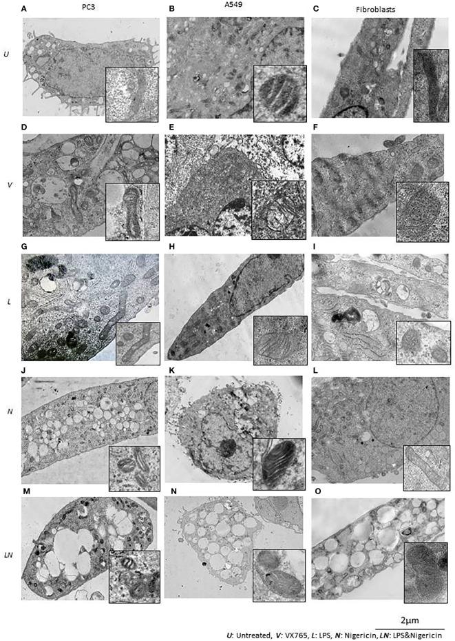 https://cdn.ncbi.nlm.nih.gov/pmc/blobs/27fe/7887322/ec352292d2bd/fimmu-11-607881-g005.jpg
