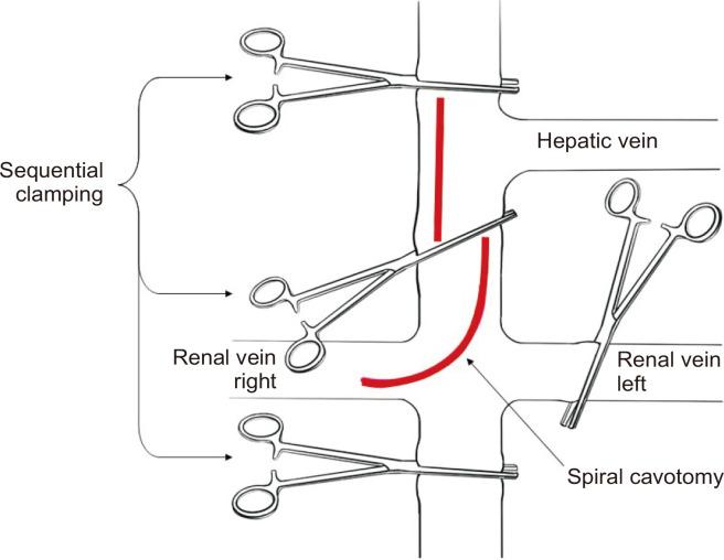 https://cdn.ncbi.nlm.nih.gov/pmc/blobs/2809/10480049/6ddcab94aa77/vsi-39-23-f4.jpg