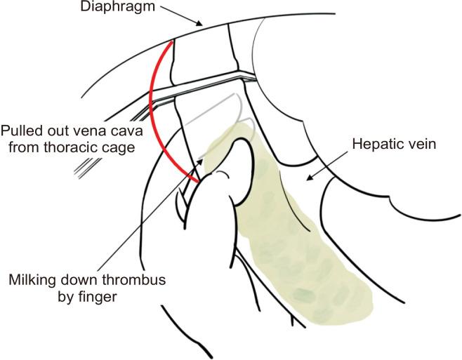 https://cdn.ncbi.nlm.nih.gov/pmc/blobs/2809/10480049/fe5f20a4a0c7/vsi-39-23-f3.jpg