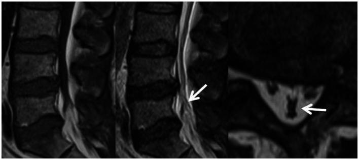 https://cdn.ncbi.nlm.nih.gov/pmc/blobs/2810/11163106/0582d5704168/fneur-15-1385770-g009.jpg