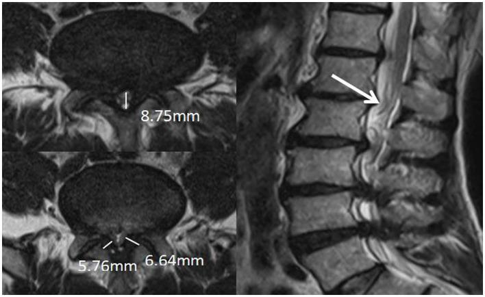 https://cdn.ncbi.nlm.nih.gov/pmc/blobs/2810/11163106/1e034c73bae9/fneur-15-1385770-g007.jpg