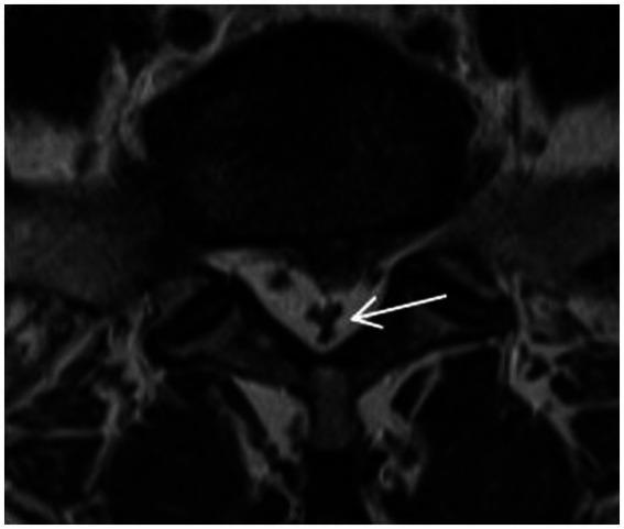 https://cdn.ncbi.nlm.nih.gov/pmc/blobs/2810/11163106/5a2136dfccd4/fneur-15-1385770-g005.jpg