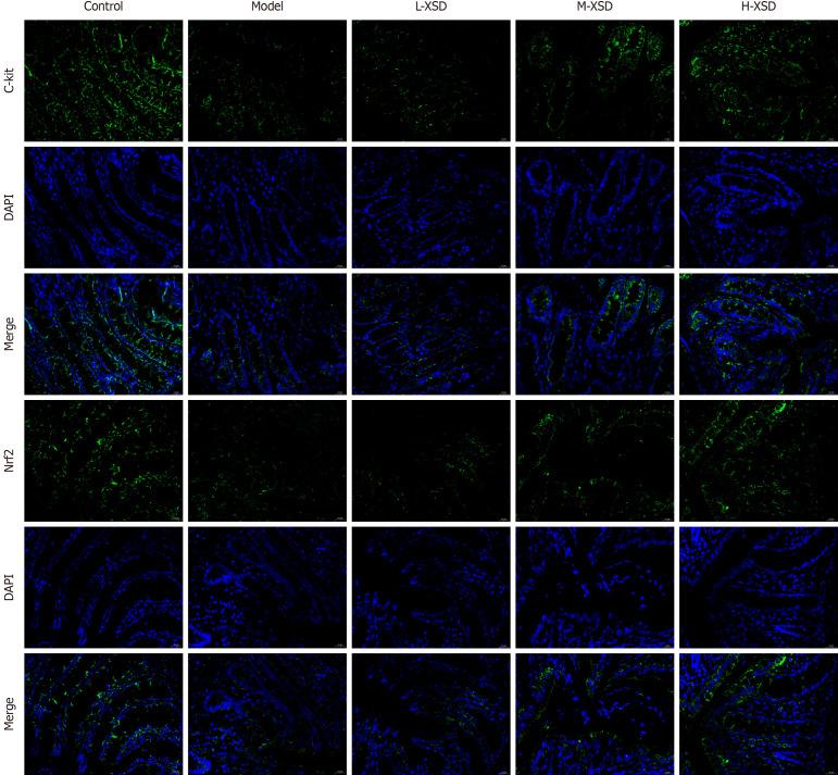 https://cdn.ncbi.nlm.nih.gov/pmc/blobs/2811/12404096/6dcea4983c7f/wjg-31-30-109187-g008.jpg