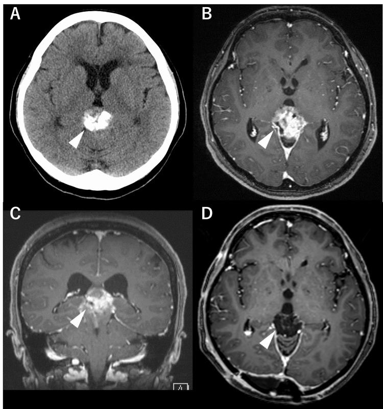 https://cdn.ncbi.nlm.nih.gov/pmc/blobs/2816/11055966/61f4921d3934/cureus-0016-00000057147-i01.jpg