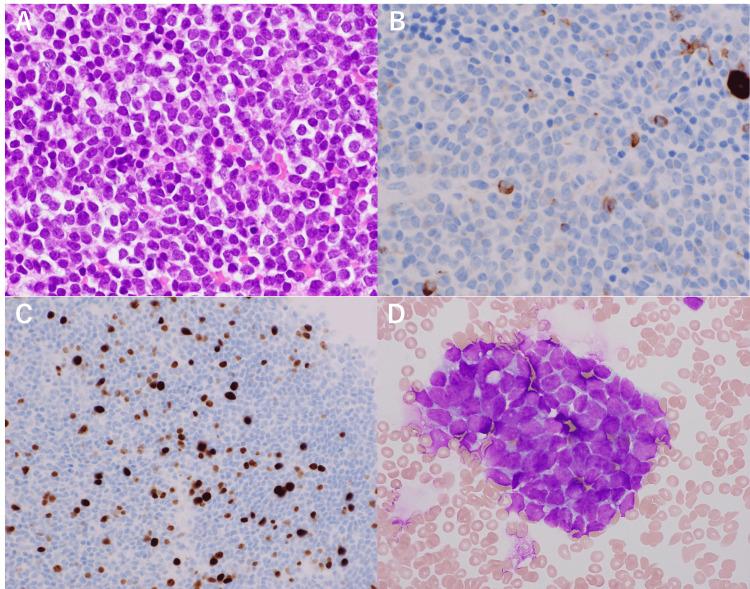 https://cdn.ncbi.nlm.nih.gov/pmc/blobs/2816/11055966/aa307c7bbcbf/cureus-0016-00000057147-i05.jpg