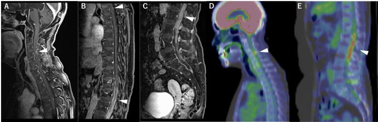 https://cdn.ncbi.nlm.nih.gov/pmc/blobs/2816/11055966/dd54af02419f/cureus-0016-00000057147-i03.jpg