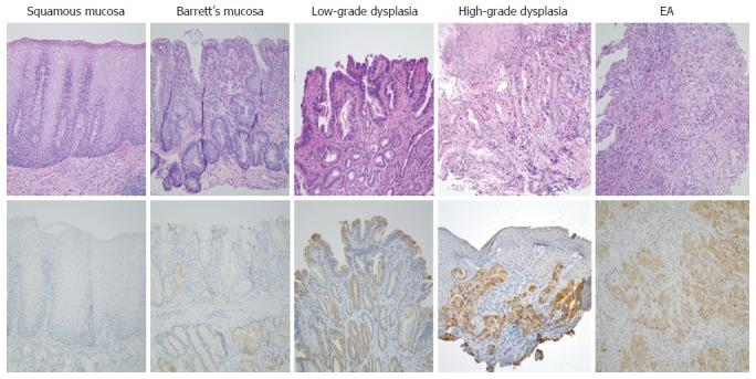 https://cdn.ncbi.nlm.nih.gov/pmc/blobs/2817/5330818/d001829783d7/WJG-23-1338-g002.jpg