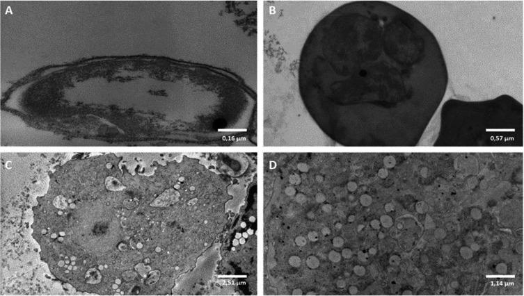 https://cdn.ncbi.nlm.nih.gov/pmc/blobs/2818/10443459/85c13b446a18/parasite-30-31-fig5.jpg