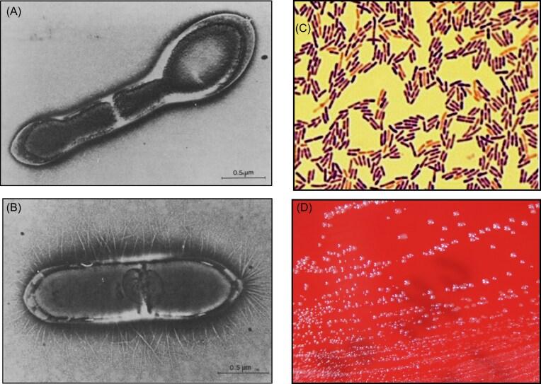 https://cdn.ncbi.nlm.nih.gov/pmc/blobs/2819/12065433/3563d032c70d/fuaf016fig3.jpg